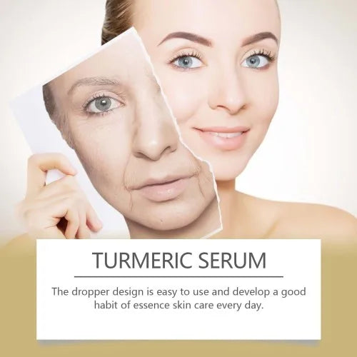 Hoygi Turmeric Essence Hydrates  Moisturizes And Nourishes Face  Moisturizes  Rejuvenates And Brightening Turmeric Care