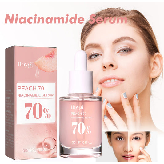 Hoygi Nicotinamide for Essence 30ml OBM Supply Tights and Moisturizes Pores Lightens Acne Marks and Spots Brightens Skin